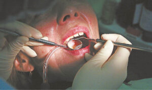 Darbus atnaujinantys stomatologai sutrikę dėl itin griežtų reikalavimų, o pacientai dėl įkainių. 